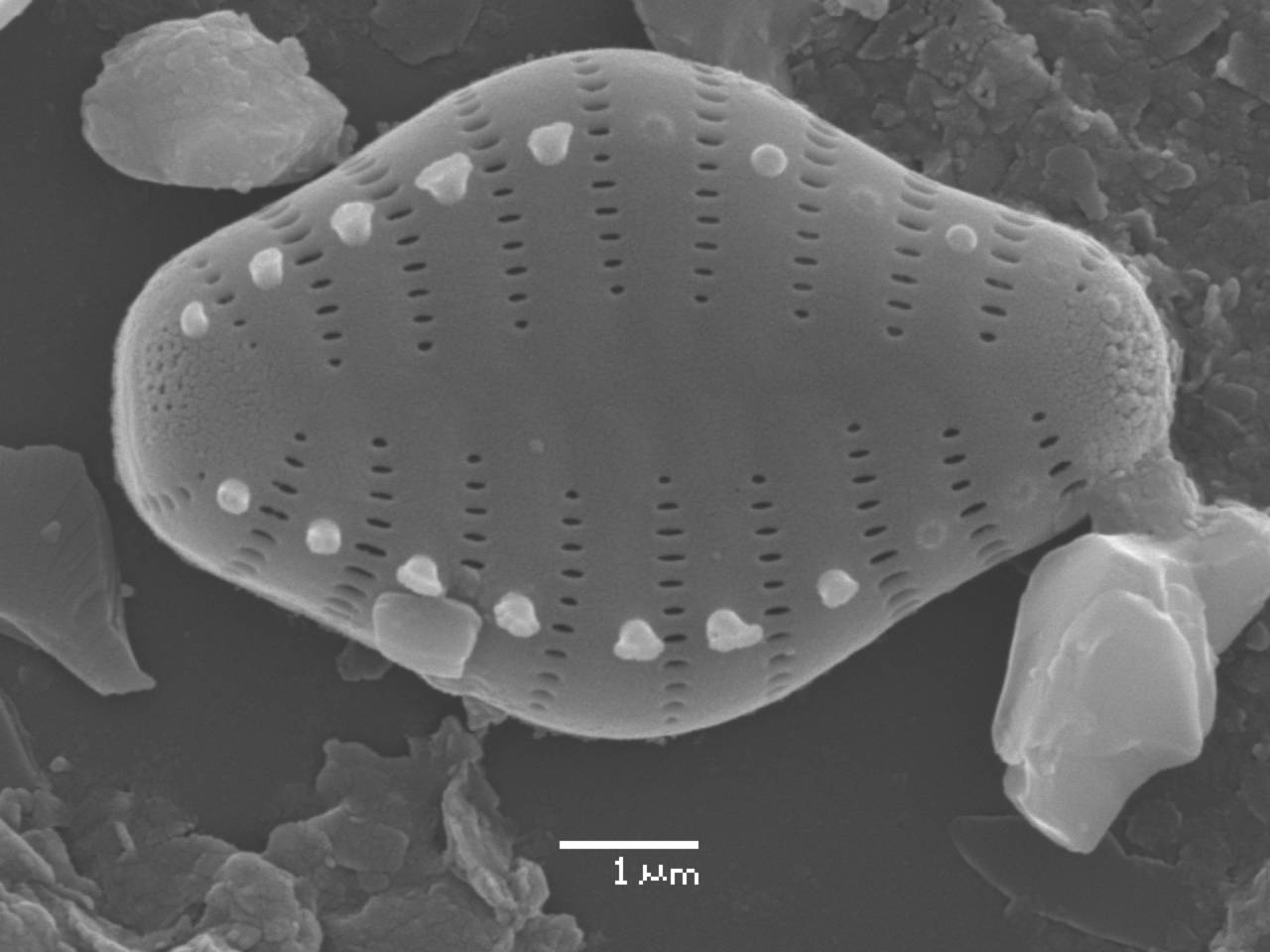 Масштаб - 10 мкм., Рузский район, Moscow Oblast (Russia)