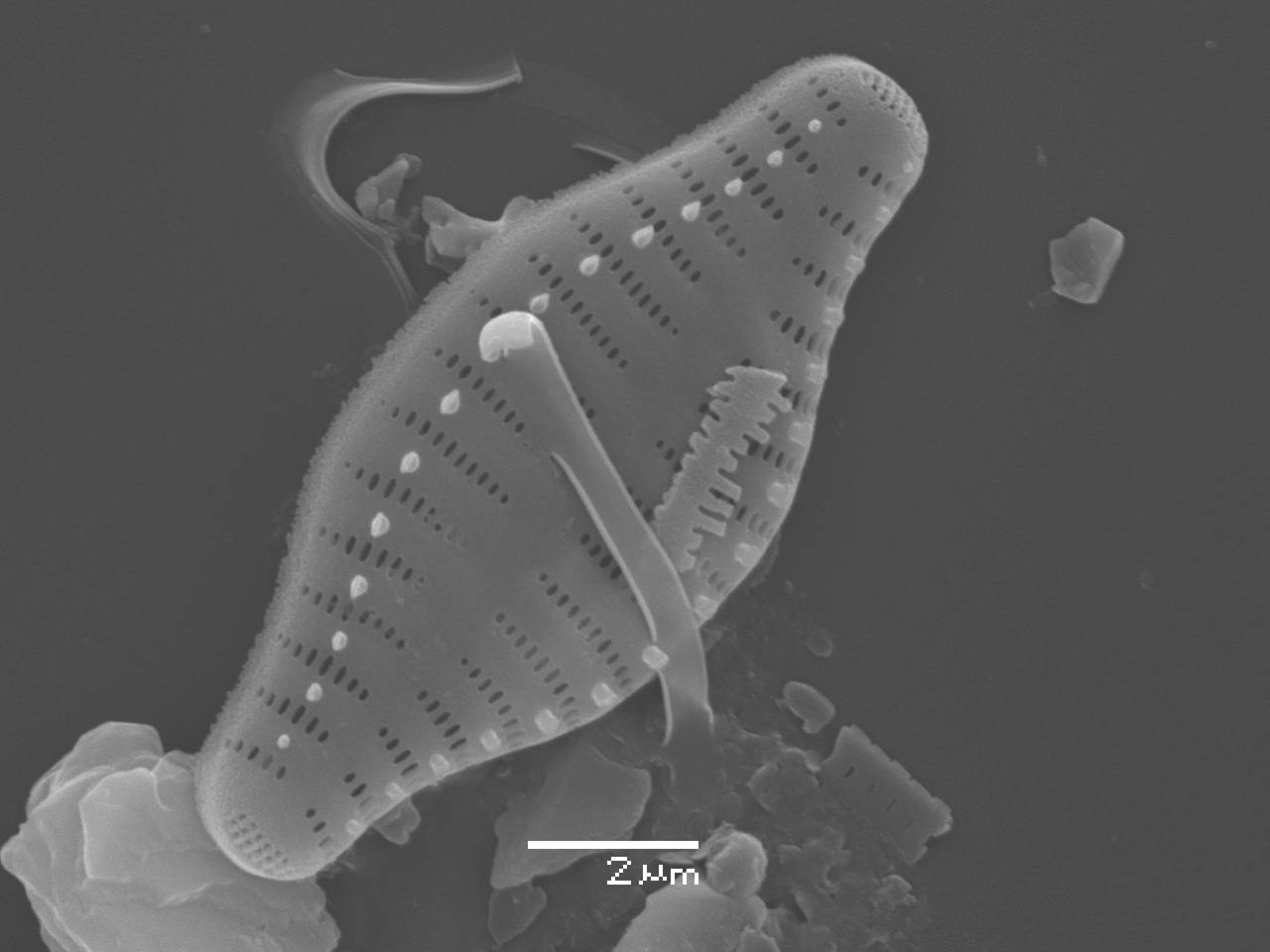 Масштаб - 10 мкм., Рузский район, Moscow Oblast (Russia)