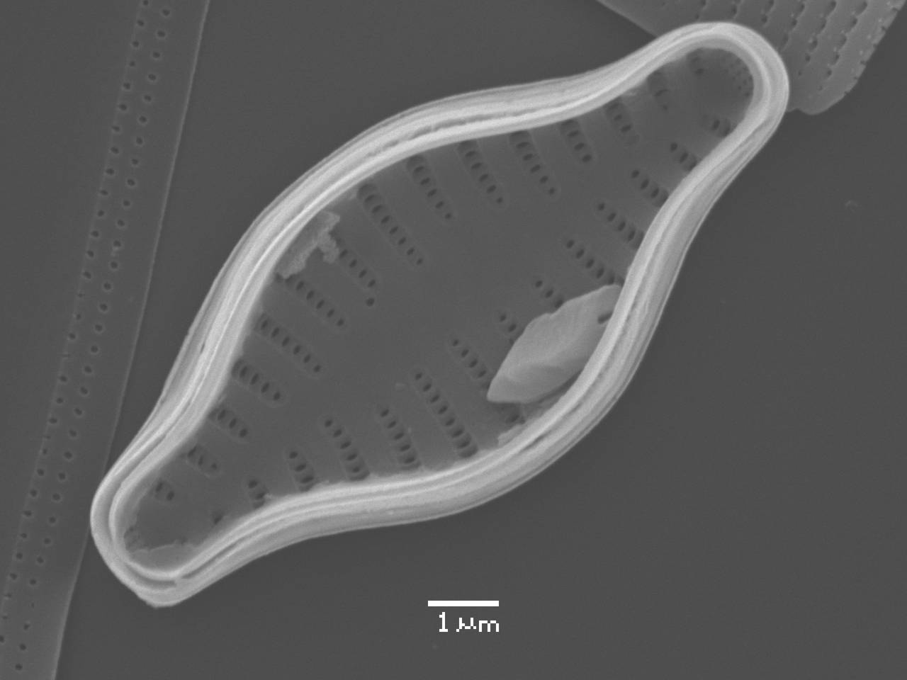 Масштаб - 10 мкм., Рузский район, Moscow Oblast (Russia)