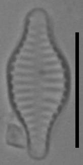 Масштаб - 10 мкм., Рузский район, Moscow Oblast (Russia)