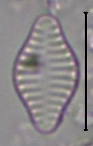 Масштаб - 10 мкм., Рузский район, Moscow Oblast (Russia)