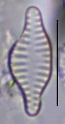 Масштаб - 10 мкм., Рузский район, Moscow Oblast (Russia)