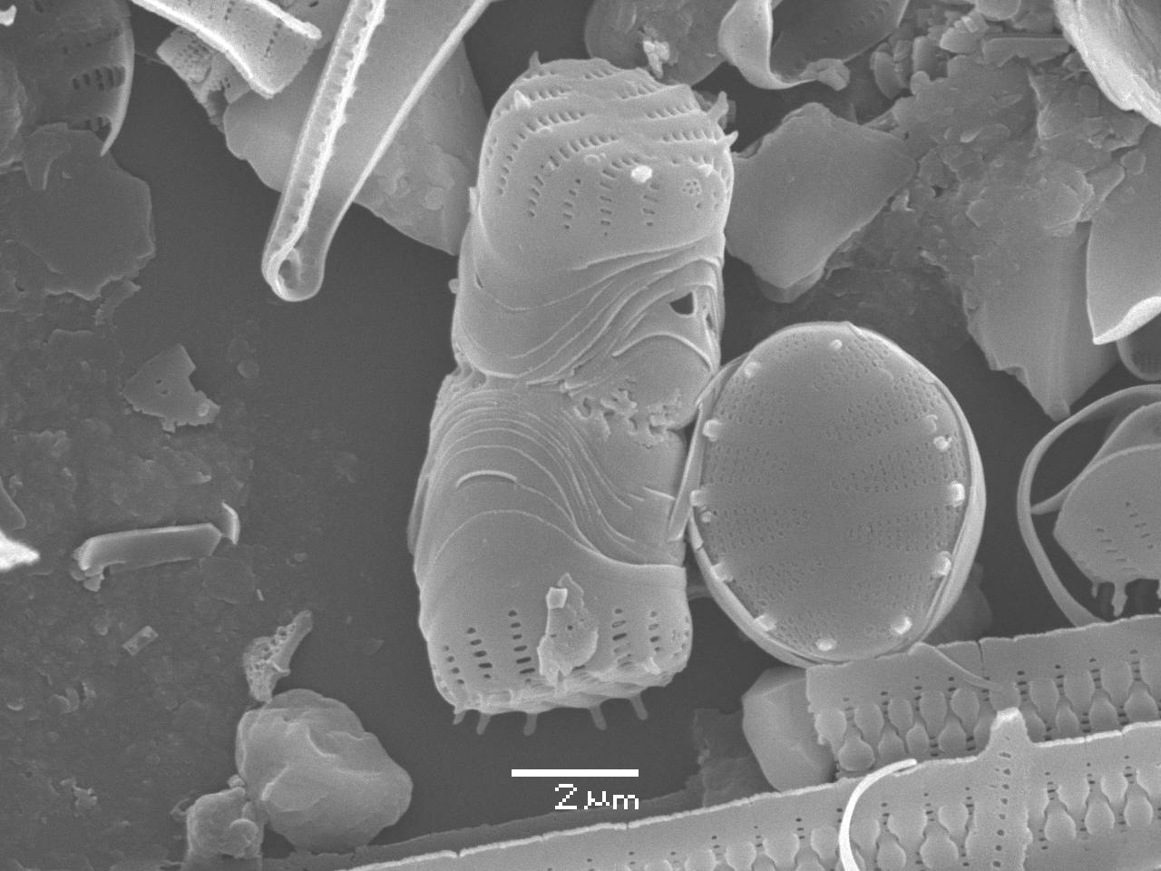 Масштаб - 10 мкм., Рузский район, Moscow Oblast (Russia)