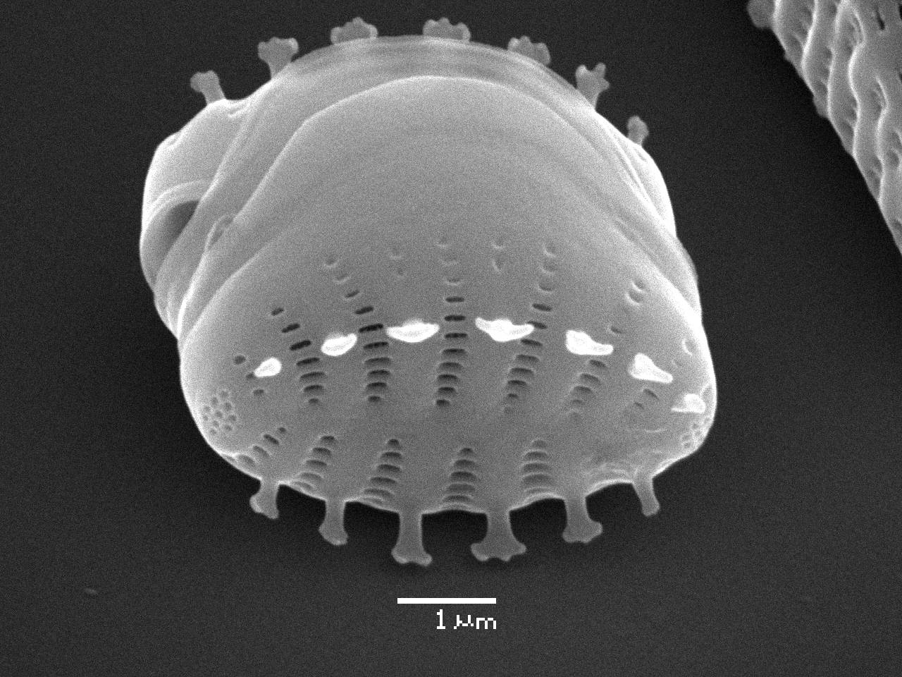 Масштаб - 10 мкм., Рузский район, Moscow Oblast (Russia)