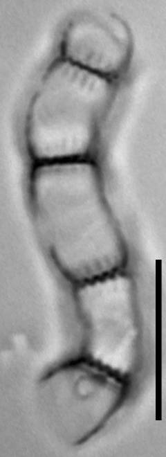 Масштаб - 10 мкм., Рузский район, Moscow Oblast (Russia)