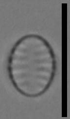 Масштаб - 10 мкм., Рузский район, Moscow Oblast (Russia)