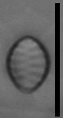 Масштаб - 10 мкм., Рузский район, Moscow Oblast (Russia)