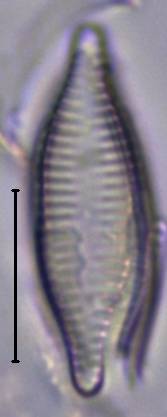 Масштаб - 10 мкм., Рузский район, Moscow Oblast (Russia)