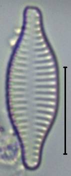 Масштаб - 10 мкм., Рузский район, Moscow Oblast (Russia)