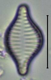 Масштаб - 10 мкм., Рузский район, Moscow Oblast (Russia)
