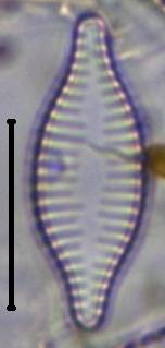 Масштаб - 10 мкм., Рузский район, Moscow Oblast (Russia)