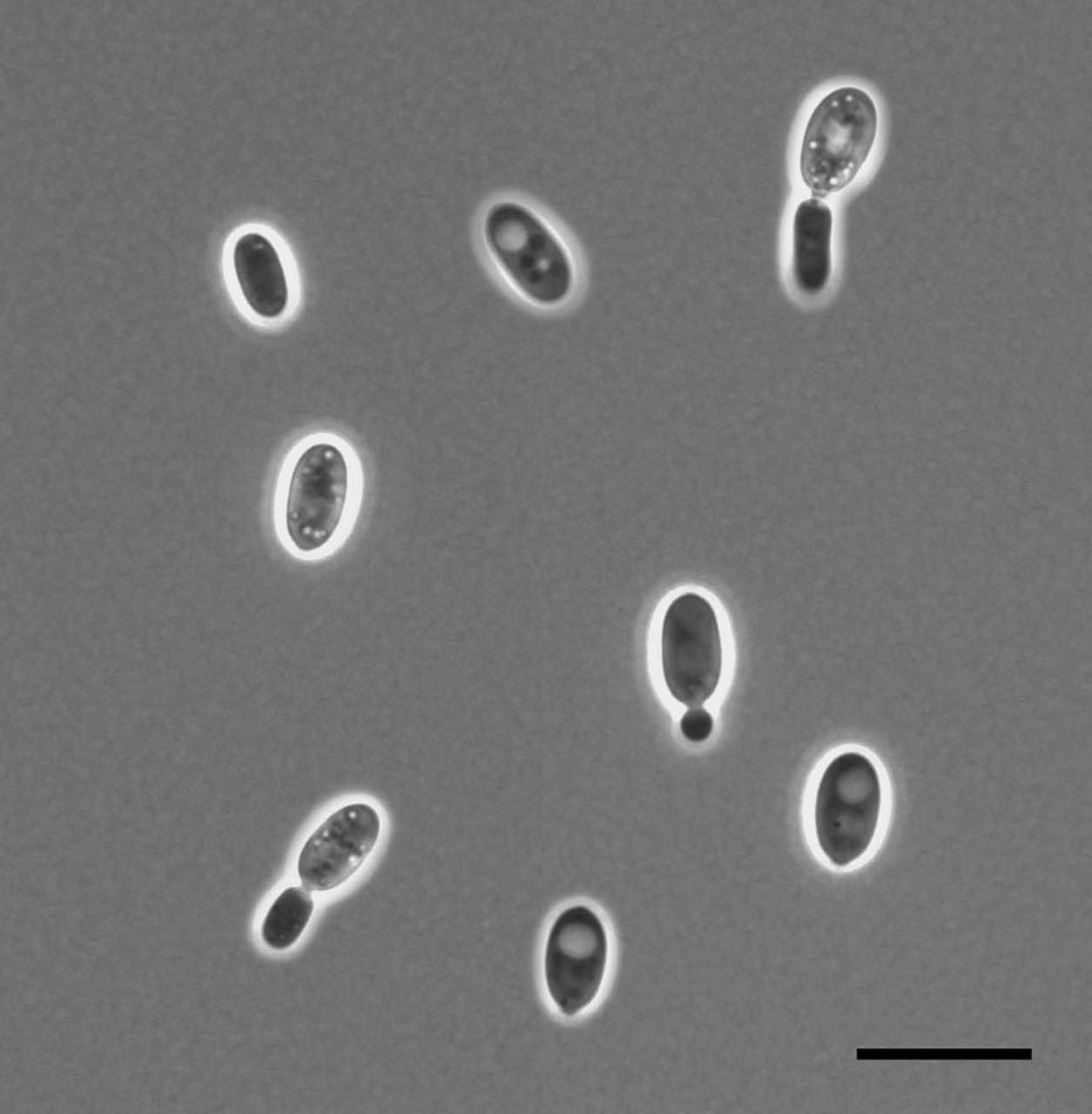 Phase contrast micrograph of Cystobasidium psychroaquaticum
K-833T (CBS 11769T). Yeast cells reproducing by budding after 7 days on GPY agar at room temperature, bar = 10 mkm, Пушкинский р-н, Moscow Oblast (Russia)