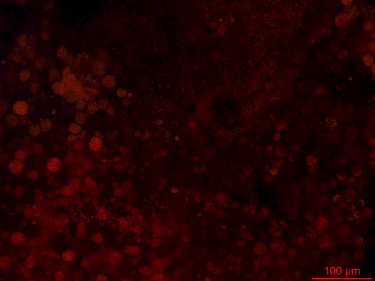 Фрагмент исходной пробы. Многочисленные гематоцисты H.pluvialis, клетки зеленых микроводорослей, одноклеточных цианобактерий и бактерий (2), Лоухский район, Ругозеская губа Кандалакшского залива Белого моря, полуостров Киндо, Karelia (Russia)
