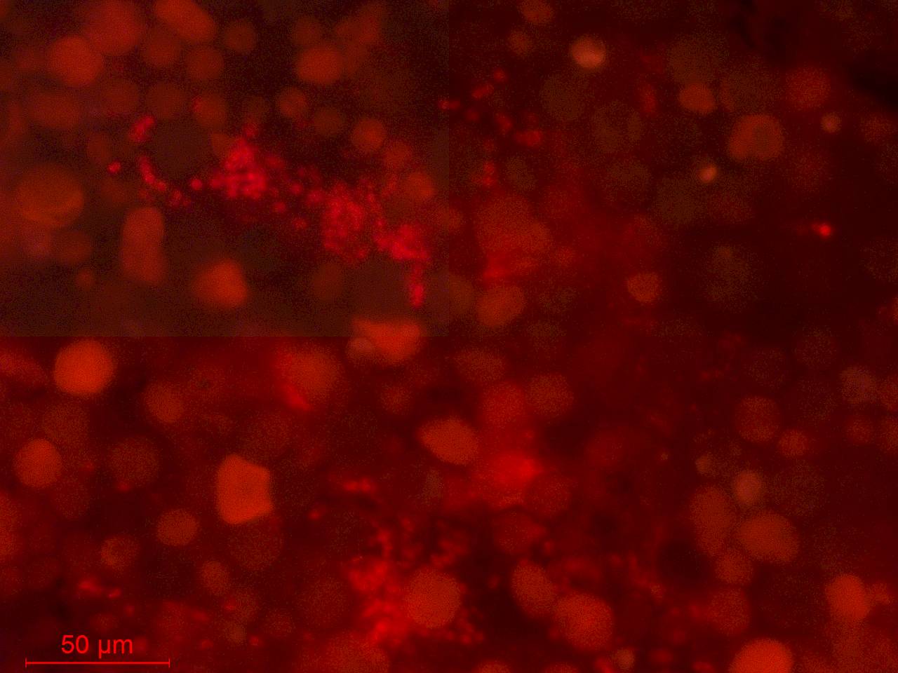 Фрагмент исходной пробы. Многочисленные гематоцисты H.pluvialis, клетки зеленых микроводорослей, одноклеточных цианобактерий и бактерий (2), Лоухский район, Ругозеская губа Кандалакшского залива Белого моря, полуостров Киндо, Karelia (Russia)
