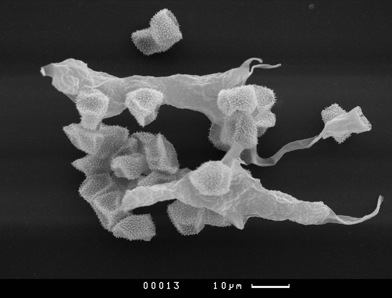 Physarum polycephalum, узелки капиллиция и споры, СЭМ, (Russia)