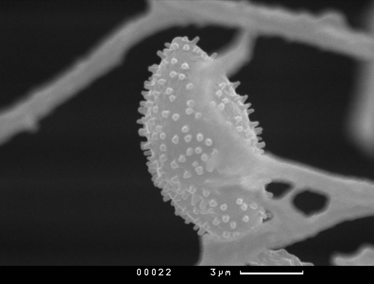 Paradiacheopsis longipes, внешний вид спороносной части, СЭМ, Кандалакшский, Karelia (Russia)