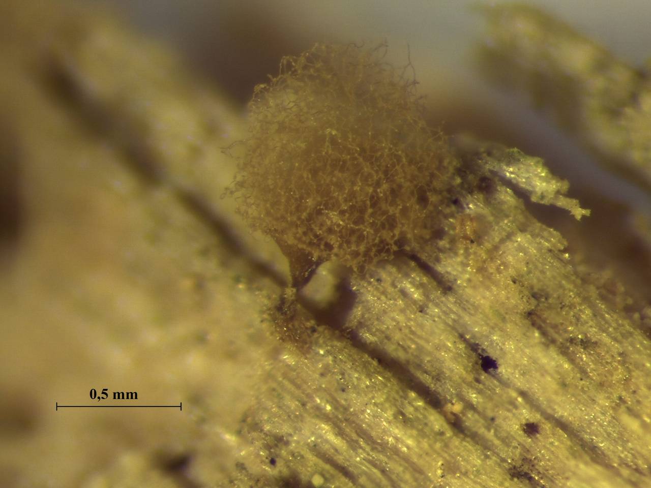 Arcyria pomiformis внешний вид спороношения, Чугеевский, Primorsky Krai (Russia)