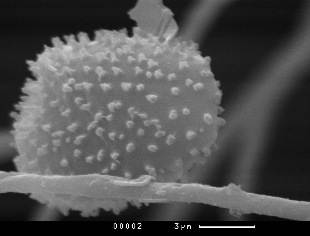 Lamprderma gulielmae внешний вид спорангия. Хорошо заметны углубления на поверхности перидия, СЭМ, Нелидовский, Tver Oblast (Russia)