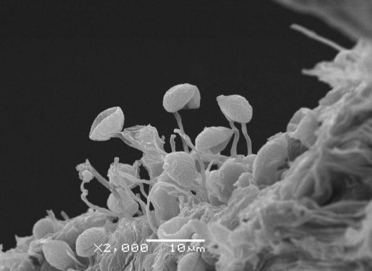 Certiomyxa fruticulosa, споры на индивидуальных ножках, СЭМ, Нелидовский, Tver Oblast (Russia)