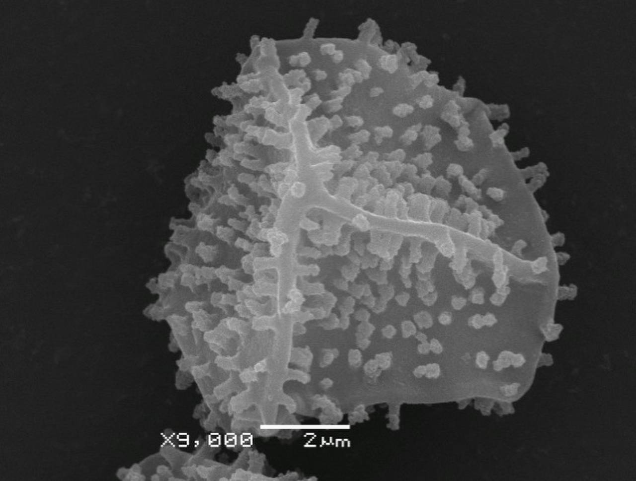 Physarum spectabile споры, СЭМ, Нелидовский, Tver Oblast (Russia)