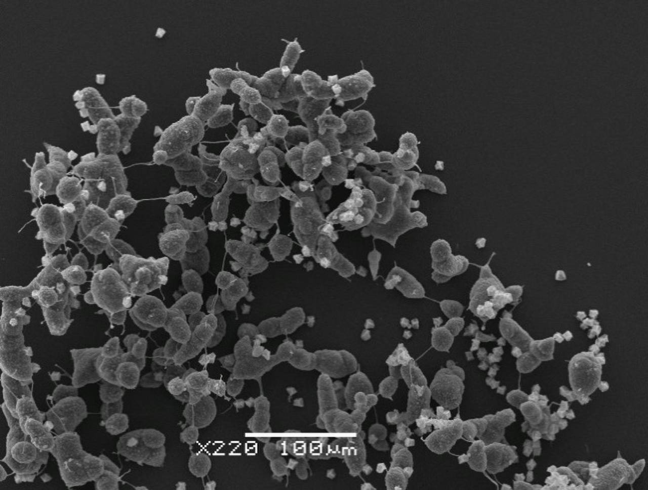 Physarum spectabile споры, СЭМ, Нелидовский, Tver Oblast (Russia)