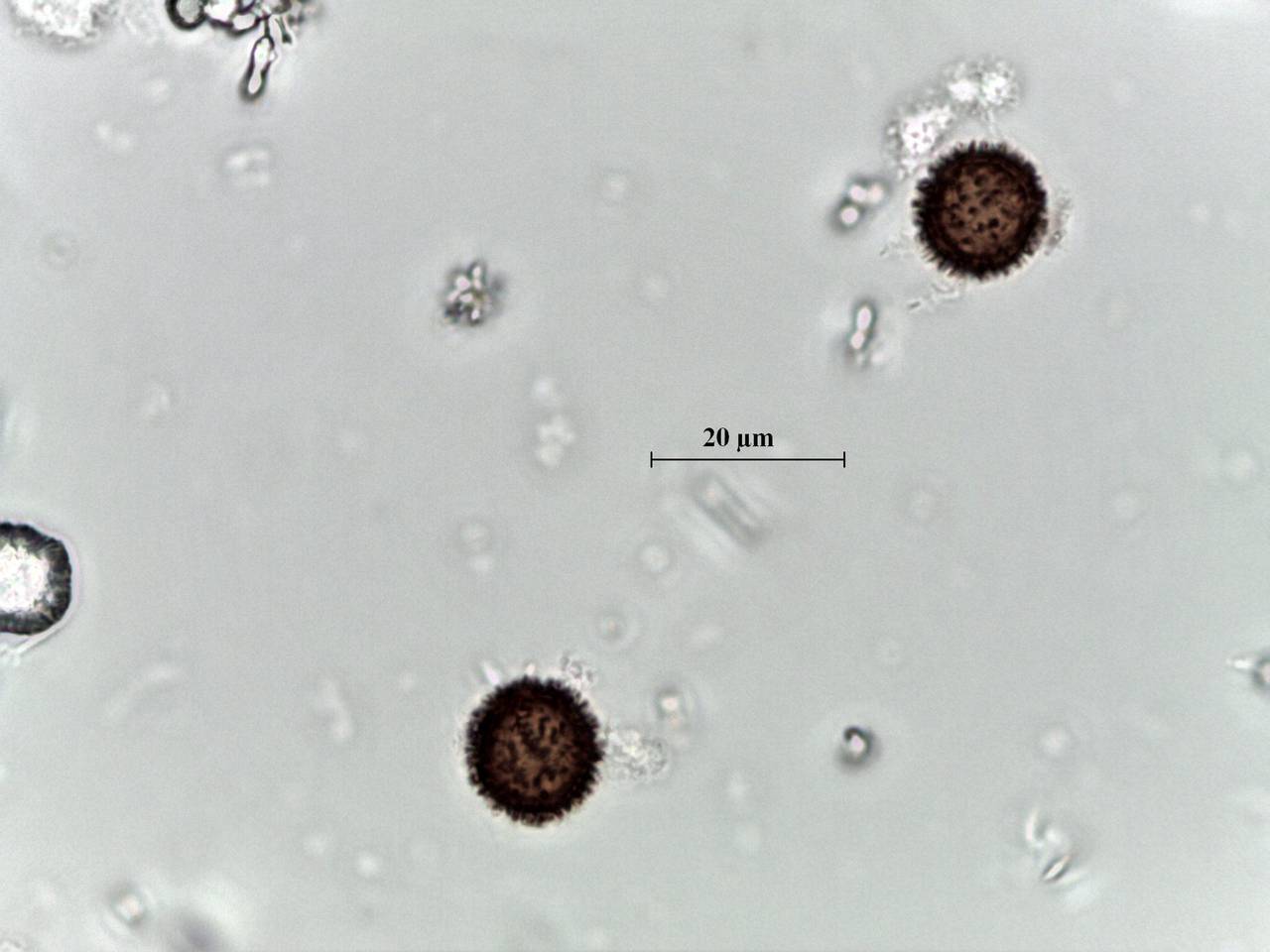 Didymium flexuosum внешний вид спороношения. Заметна продолговатая и уплощенная сбоков колонка, Калининский, Tver Oblast (Russia)