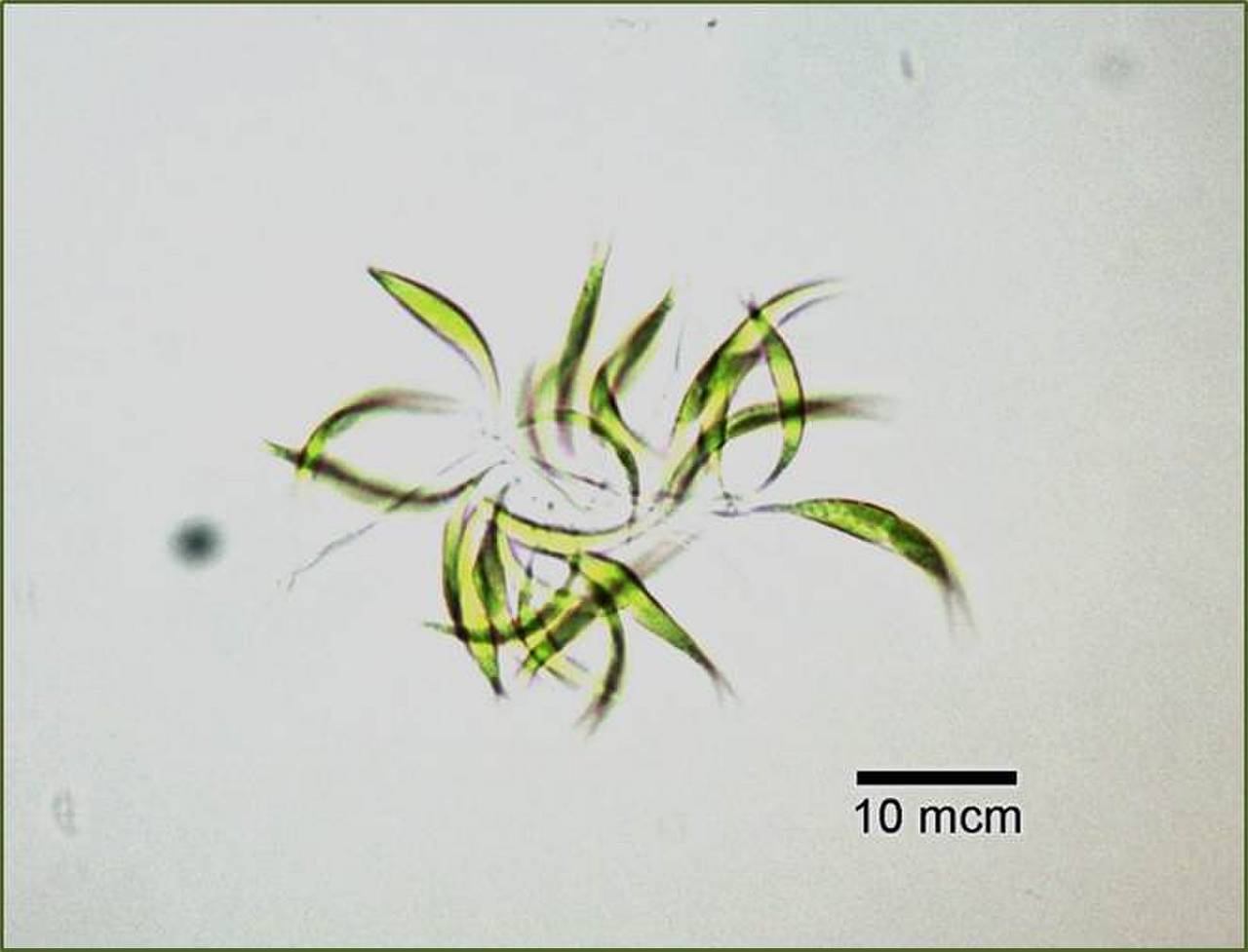 Ankistrodesmus sp. Сах.Головкаред.4а, Балаклавский район, пос. Сахарная Головка, Sevastopol (Russia)