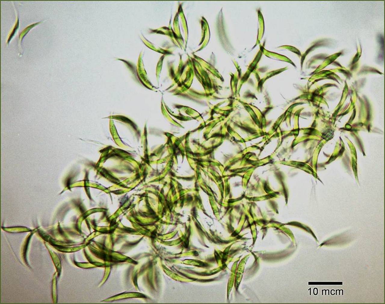 Ankistrodesmus sp. Сах.Головкаред.4а, Балаклавский район, пос. Сахарная Головка, Sevastopol (Russia)
