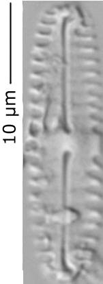 Pinnularia_lager_245-250, о. Шемья (Shemya), Alaska (United States)