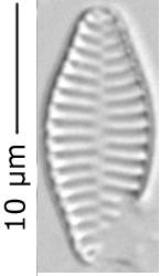 Staurosira_constr_var_venter_310-318, о. Шемья (Shemya), Alaska (United States)