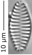 Staurosira_constr_var_venter_350-355, о. Шемья (Shemya), Alaska (United States)