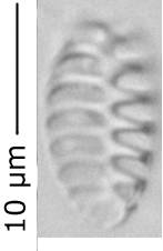 Staurosirella_mart_290-296, о. Шемья (Shemya), Alaska (United States)