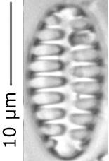 Staurosirella_mart_318-320, о. Шемья (Shemya), Alaska (United States)