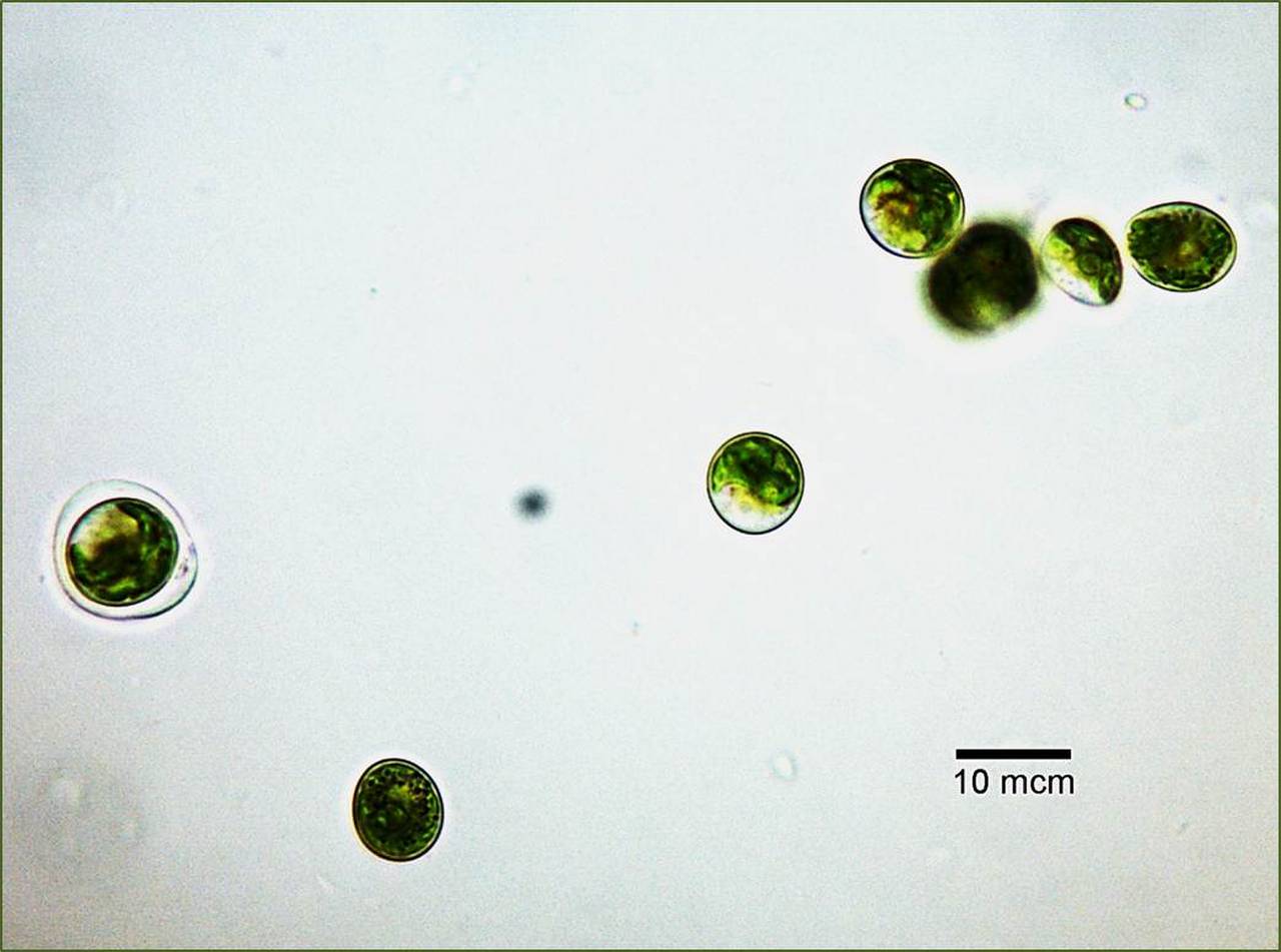 Ettlia ACKU ред.1, (Czechoslovakia)