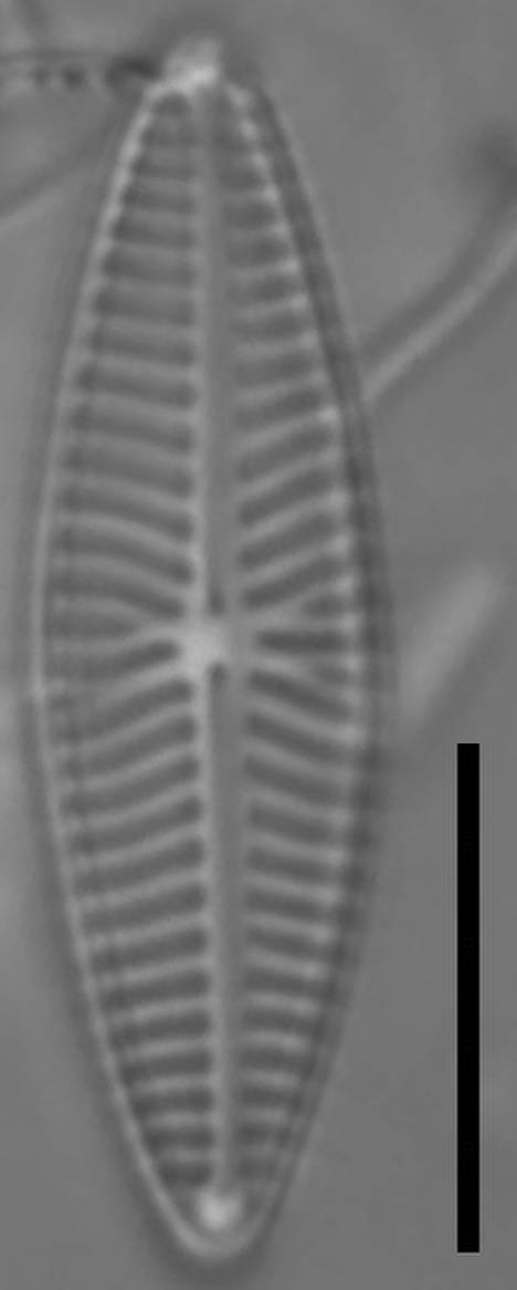 Масштаб - 10 мкм, Одинцовский район, Moscow Oblast (Russia)