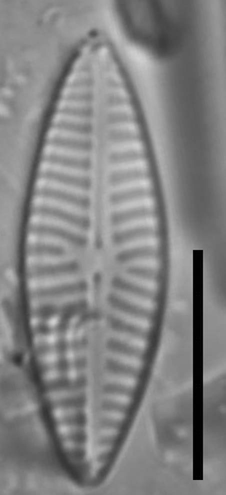 Масштаб - 10 мкм., Одинцовский район, Moscow Oblast (Russia)