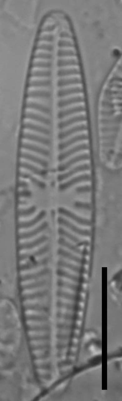 Масштаб - 10 мкм., Одинцовский район, Moscow Oblast (Russia)