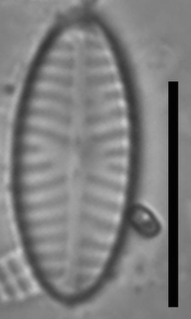 Масштаб - 10 мкм., Одинцовский район, Moscow Oblast (Russia)