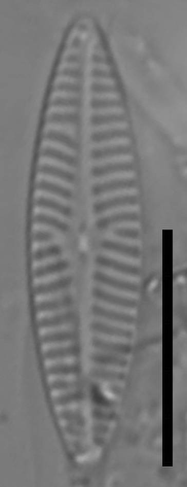 Масштаб - 10 мкм., Одинцовский район, Moscow Oblast (Russia)