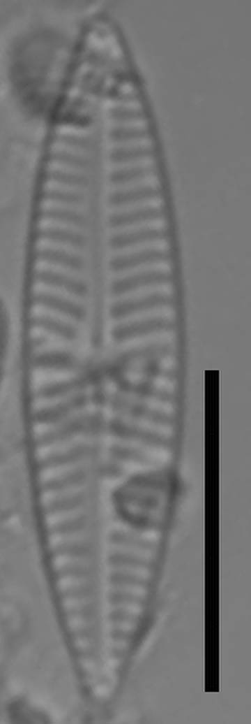 Масштаб - 10 мкм., Одинцовский район, Moscow Oblast (Russia)