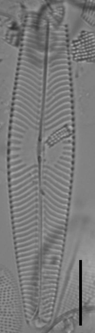 Масштаб - 10 мкм., Одинцовский район, Moscow Oblast (Russia)