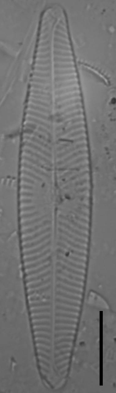 Масштаб - 10 мкм., Одинцовский район, Moscow Oblast (Russia)