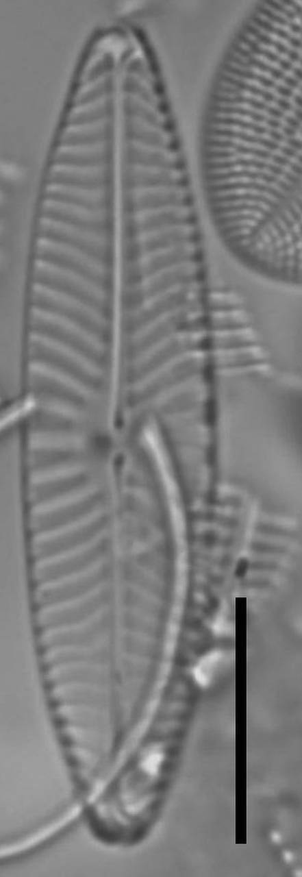 Масштаб - 10 мкм., Одинцовский район, Moscow Oblast (Russia)