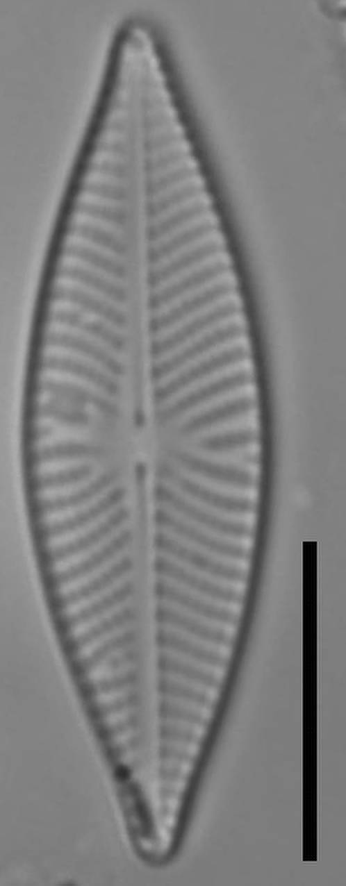 Масштаб - 10 мкм., Одинцовский район, Moscow Oblast (Russia)