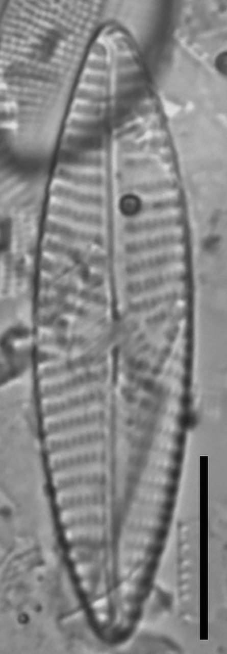 Масштаб - 10 мкм., Одинцовский район, Moscow Oblast (Russia)