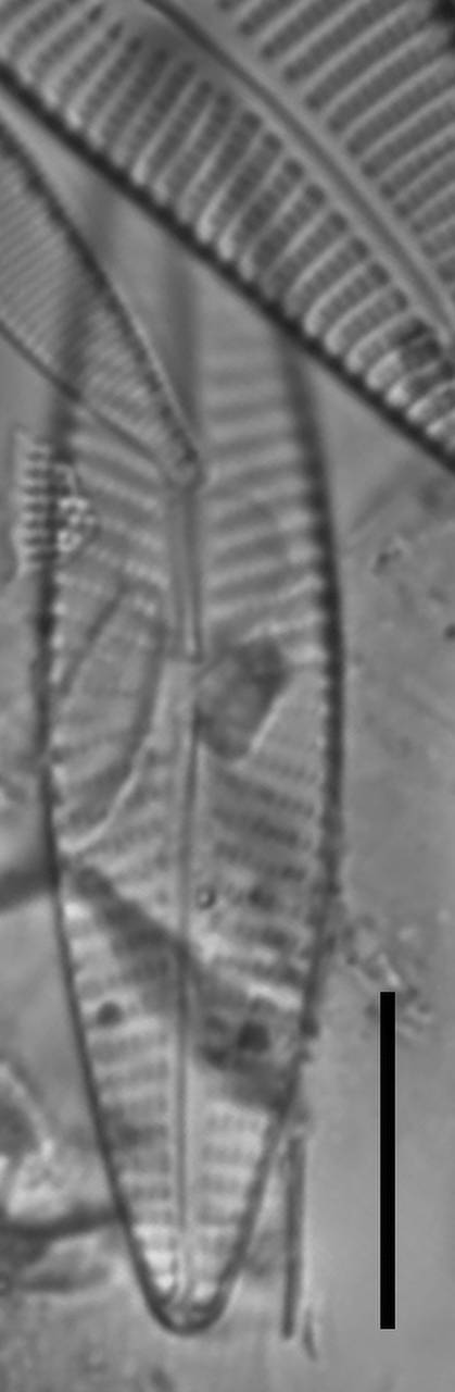 Масштаб - 10 мкм., Одинцовский район, Moscow Oblast (Russia)