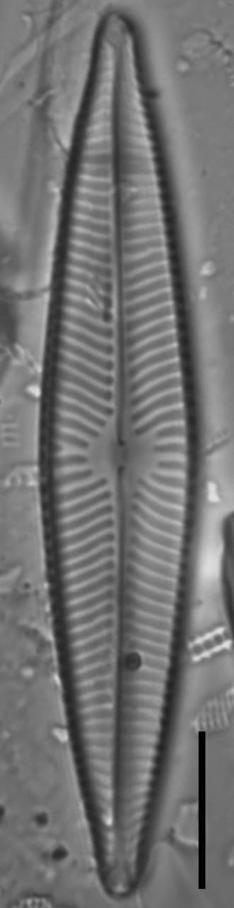 Масштаб - 10 мкм., Одинцовский район, Moscow Oblast (Russia)