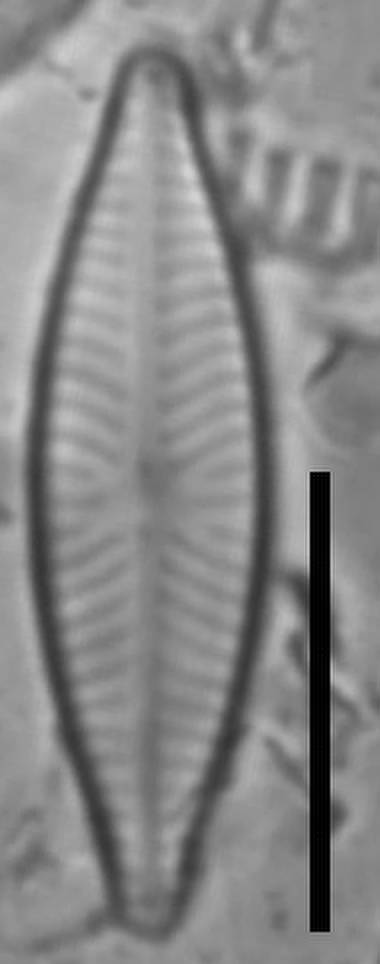 Масштаб - 10 мкм., Одинцовский район, Moscow Oblast (Russia)