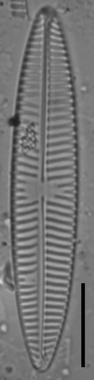 Масштаб – 10 мкм., Одинцовский район, Moscow Oblast (Russia)