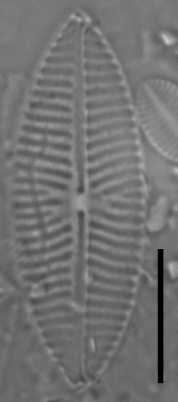 Масштаб – 10 мкм., Одинцовский район, Moscow Oblast (Russia)